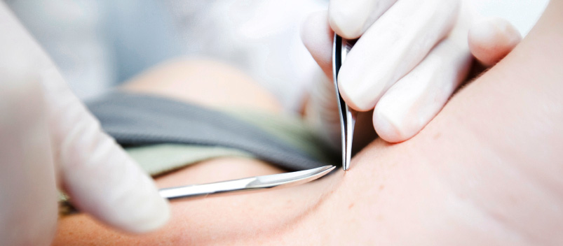 surgical-procedures