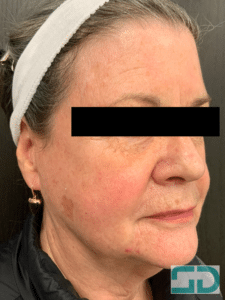 Before Image: TCA Peel