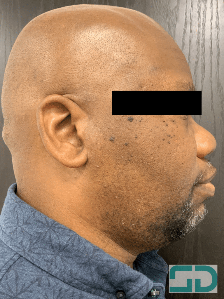 Before Image: ED&C - right-side