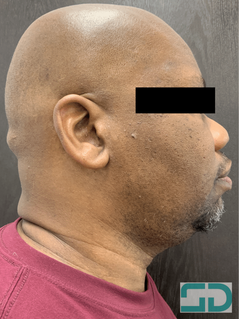 After Image: ED&C - right-side